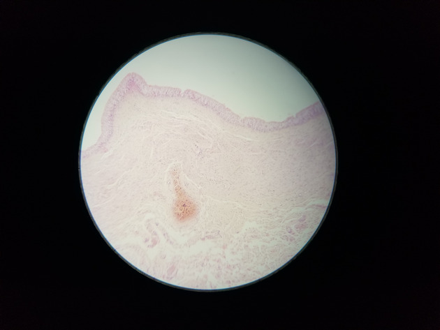 Transitional Epithelium Slides - Transitional Epithelium 02 100X